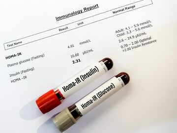 Próbki krwi do badania