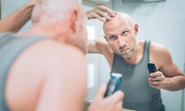 Dlaczego mężczyźni łysieją szybciej?