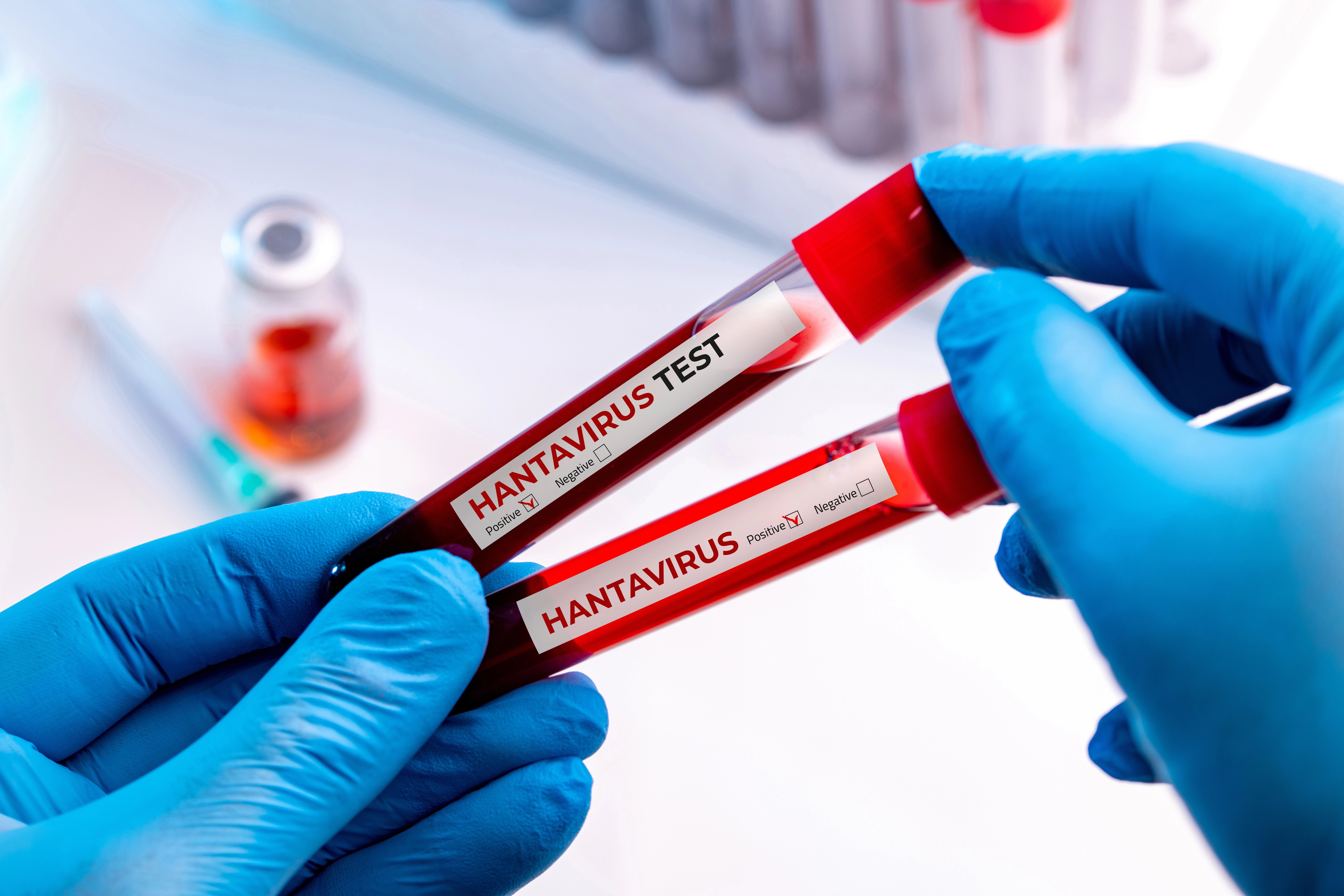 Czterech Polaków pod okiem epidemiologów z GIS. Prawdopodobny kontakt z hantawirusem. 2