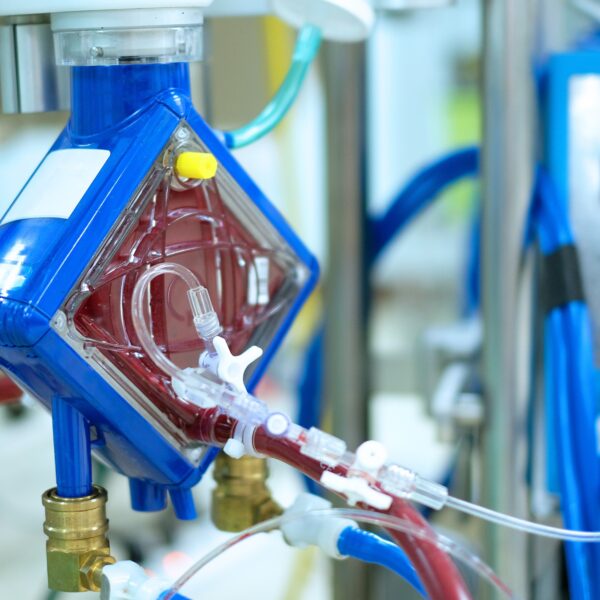 Polskie urządzenie alternatywą dla ECMO. Uzyskało amerykańską ochronę patentową.