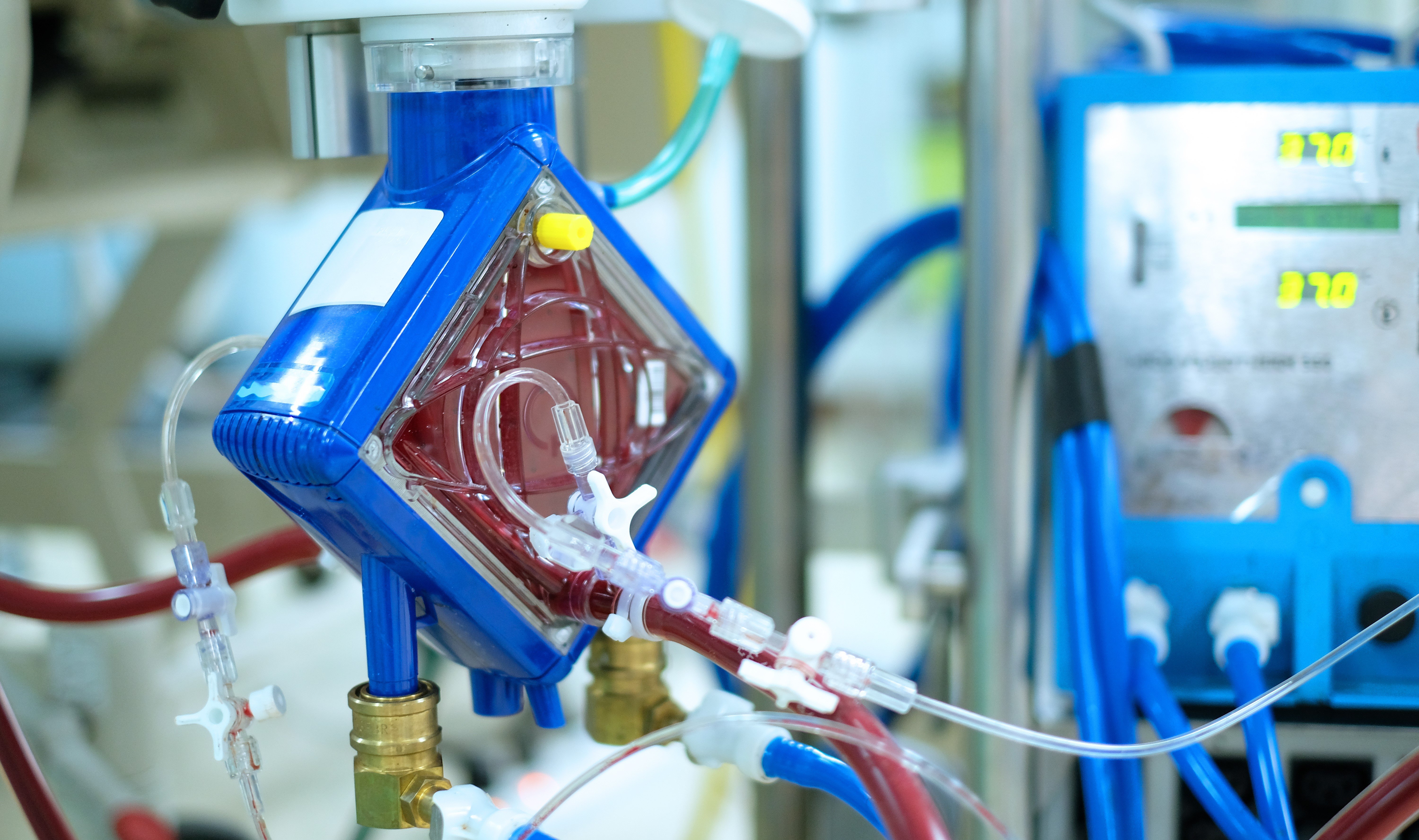 Polskie urządzenie alternatywą dla ECMO. Uzyskało amerykańską ochronę patentową. 4