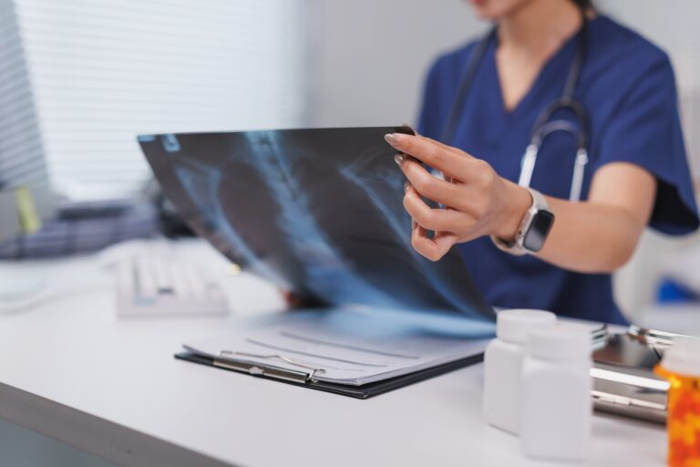 Jak obraz płuc wspiera diagnozę pacjenta 11