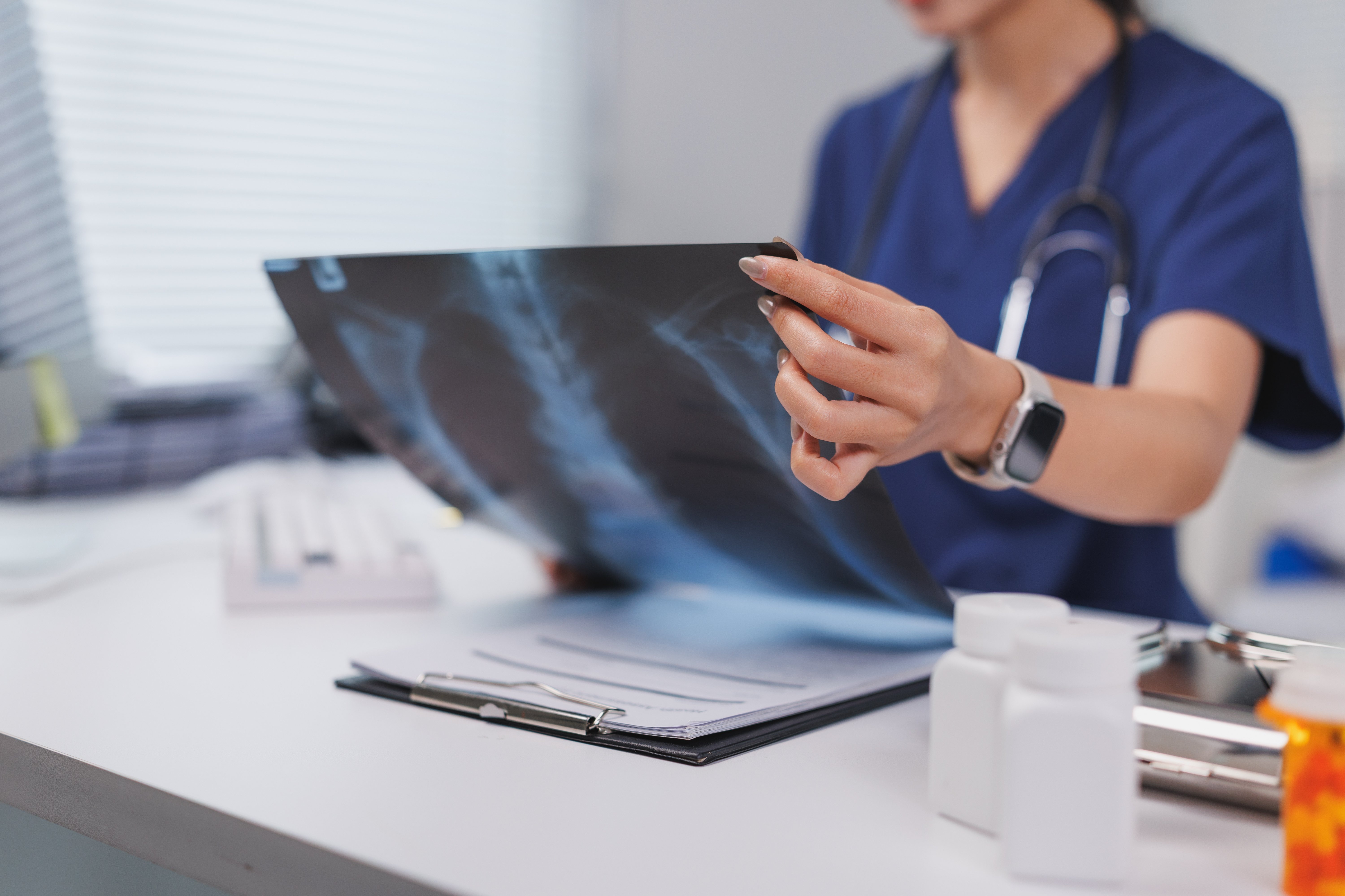 Jak obraz płuc wspiera diagnozę pacjenta 4
